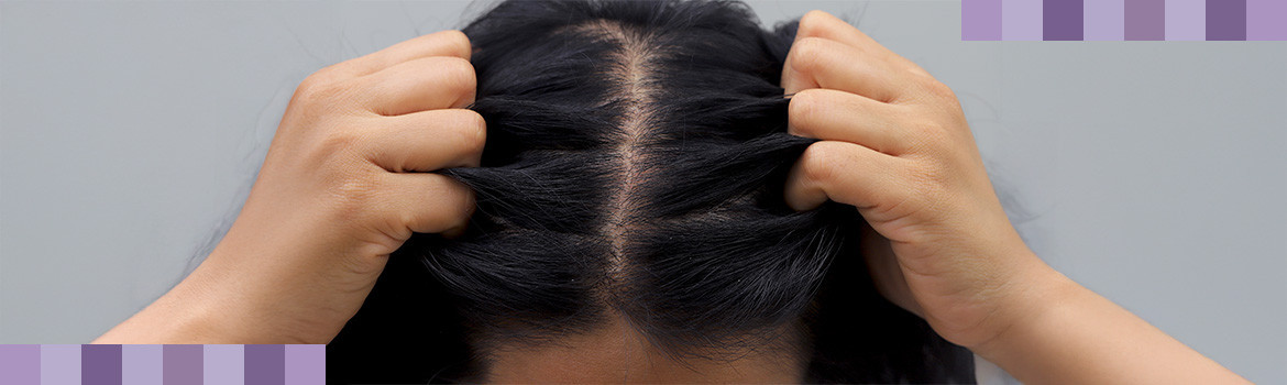 Itchy scalp: what to do and which routine to choose